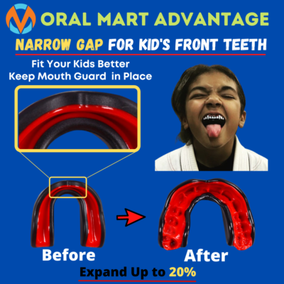 oral mart premium youth mouth guard for kids