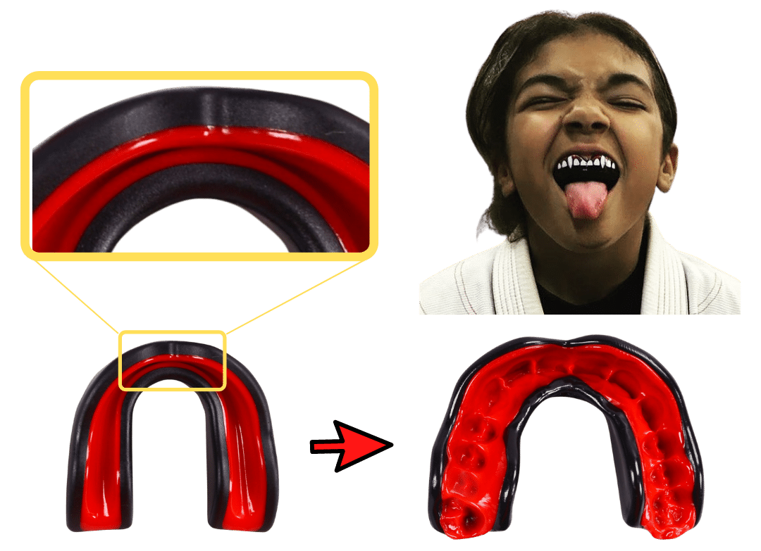 why parents love our sports mouth guard for kids