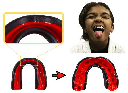 why parents love our kids mouth guard for sports